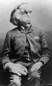 Joseph Merrick - The 'Elephant Man'